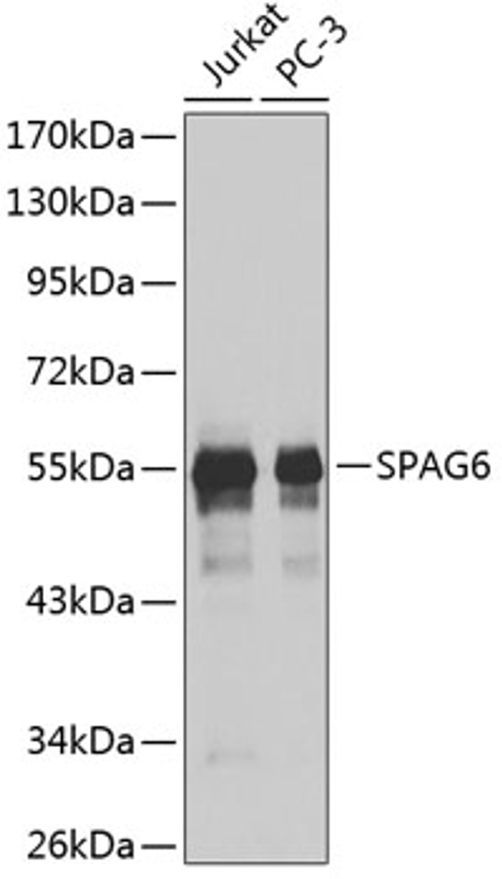 Western blot analysis of extracts of various cell lines, using SPAG6 antibody (18-936) .<br/>Secondary antibody: HRP Goat Anti-Rabbit IgG (H+L) at 1:10000 dilution.<br/>Lysates/proteins: 25ug per lane.<br/>Blocking buffer: 3% nonfat dry milk in TBST.