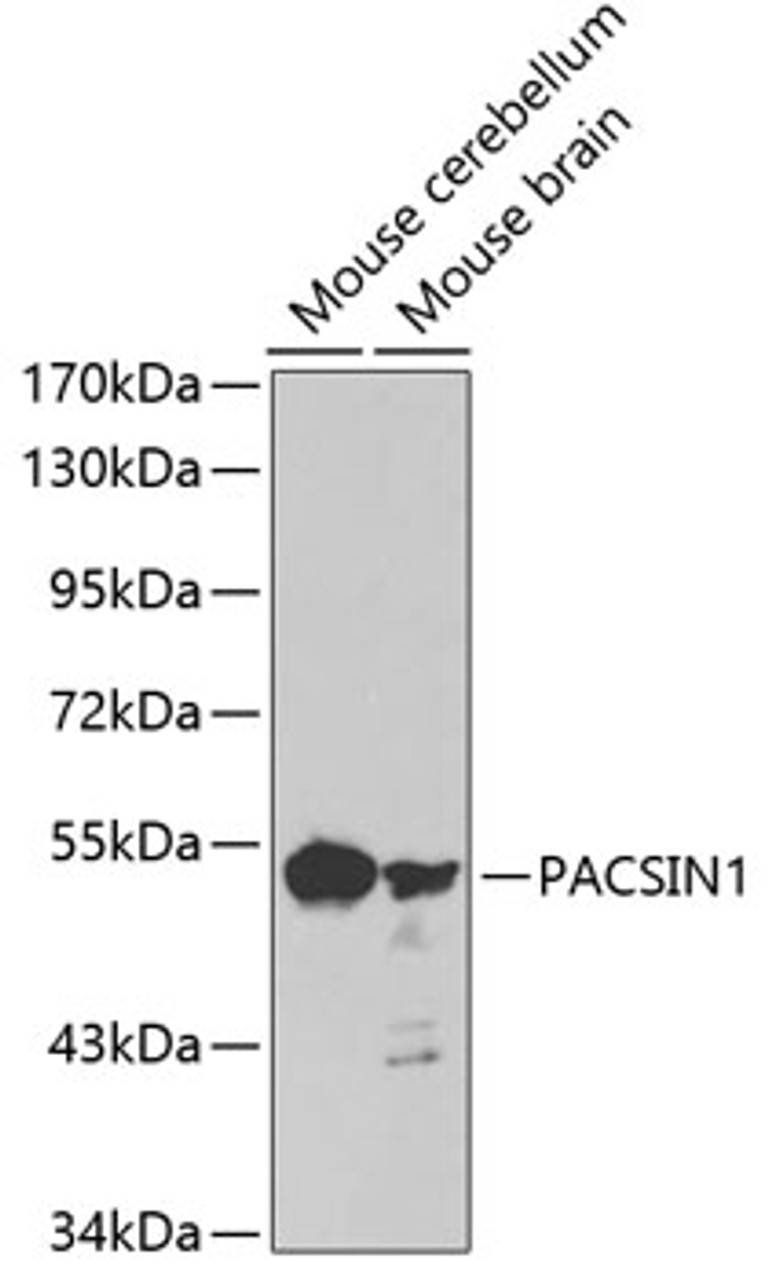 Western blot analysis of extracts of various cell lines, using PACSIN1 antibody (18-961) .<br/>Secondary antibody: HRP Goat Anti-Rabbit IgG (H+L) at 1:10000 dilution.<br/>Lysates/proteins: 25ug per lane.<br/>Blocking buffer: 3% nonfat dry milk in TBST.