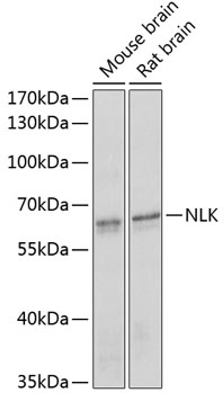 Western blot analysis of extracts of various cell lines, using NLK antibody (18-986) at 1:1000 dilution.<br/>Secondary antibody: HRP Goat Anti-Rabbit IgG (H+L) at 1:10000 dilution.<br/>Lysates/proteins: 25ug per lane.<br/>Blocking buffer: 3% nonfat dry milk in TBST.<br/>Detection: ECL Enhanced Kit.<br/>Exposure time: 90s.