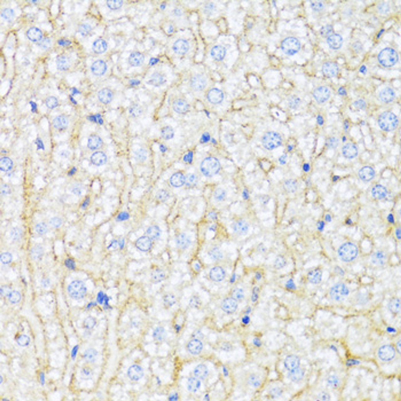 Immunohistochemistry of paraffin-embedded mouse liver using ABCA6 antibody (18-987) at dilution of 1:100 (40x lens) .