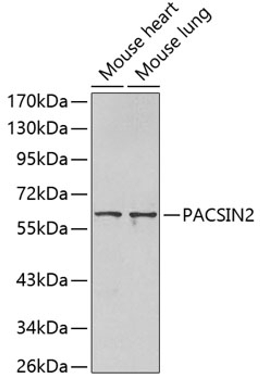 Western blot analysis of extracts of various cell lines, using PACSIN2 antibody (18-992) .<br/>Secondary antibody: HRP Goat Anti-Rabbit IgG (H+L) at 1:10000 dilution.<br/>Lysates/proteins: 25ug per lane.<br/>Blocking buffer: 3% nonfat dry milk in TBST.