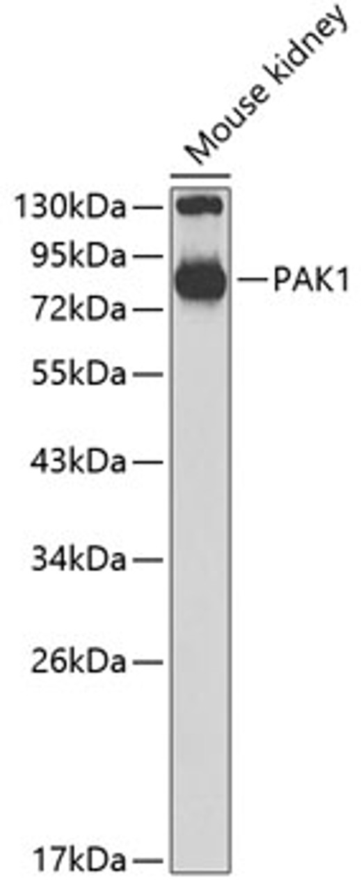 Western blot analysis of extracts of mouse kidney, using PAK1 antibody (19-016) at 1:700 dilution.<br/>Secondary antibody: HRP Goat Anti-Rabbit IgG (H+L) at 1:10000 dilution.<br/>Lysates/proteins: 25ug per lane.<br/>Blocking buffer: 3% nonfat dry milk in TBST.