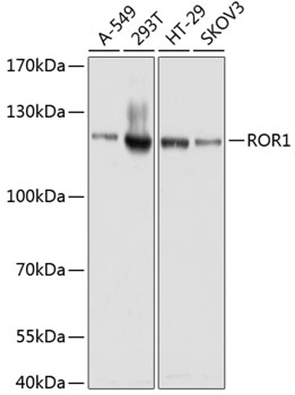 Western blot analysis of extracts of various cell lines, using ROR1 antibody (19-032) at 1:1000 dilution.<br/>Secondary antibody: HRP Goat Anti-Rabbit IgG (H+L) at 1:10000 dilution.<br/>Lysates/proteins: 25ug per lane.<br/>Blocking buffer: 3% nonfat dry milk in TBST.<br/>Detection: ECL Basic Kit.<br/>Exposure time: 30s.