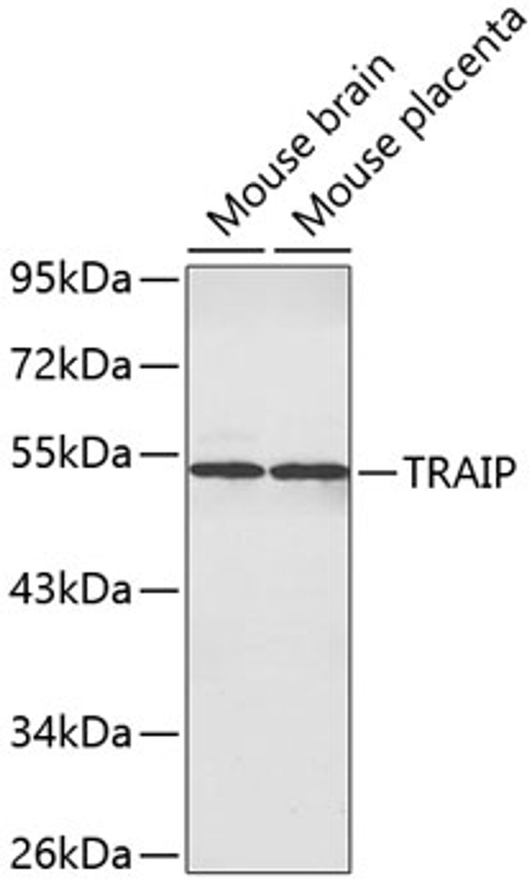 Western blot analysis of extracts of various cell lines, using TRAIP antibody (19-048) .<br/>Secondary antibody: HRP Goat Anti-Rabbit IgG (H+L) at 1:10000 dilution.<br/>Lysates/proteins: 25ug per lane.<br/>Blocking buffer: 3% nonfat dry milk in TBST.