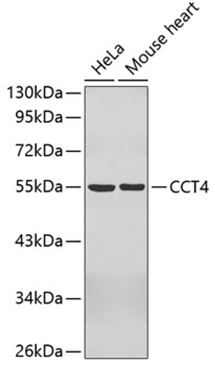 Western blot analysis of extracts of various cell lines, using CCT4 antibody (19-050) .<br/>Secondary antibody: HRP Goat Anti-Rabbit IgG (H+L) at 1:10000 dilution.<br/>Lysates/proteins: 25ug per lane.<br/>Blocking buffer: 3% nonfat dry milk in TBST.