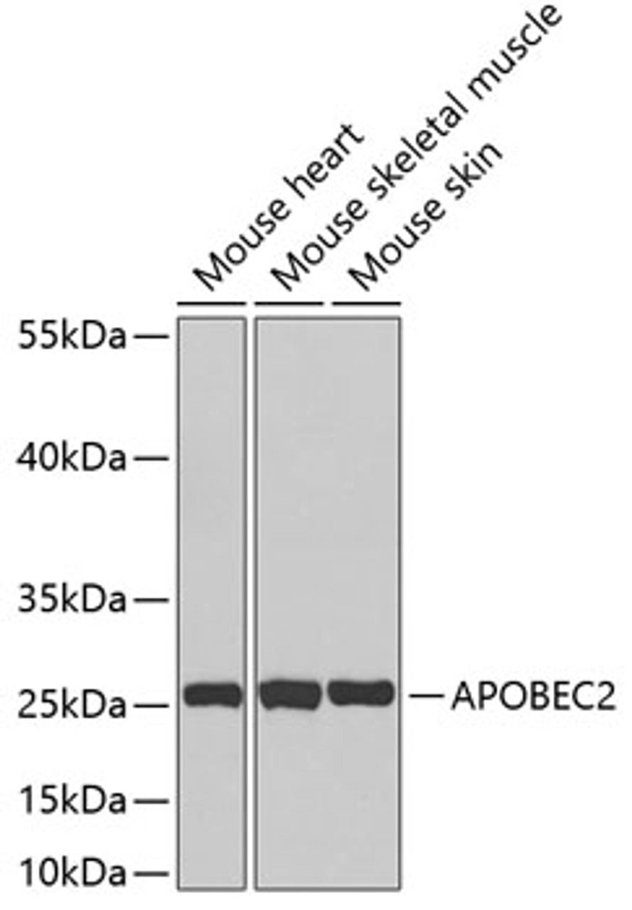 Western blot analysis of extracts of various cell lines, using APOBEC2 antibody (19-051) .<br/>Secondary antibody: HRP Goat Anti-Rabbit IgG (H+L) at 1:10000 dilution.<br/>Lysates/proteins: 25ug per lane.<br/>Blocking buffer: 3% nonfat dry milk in TBST.