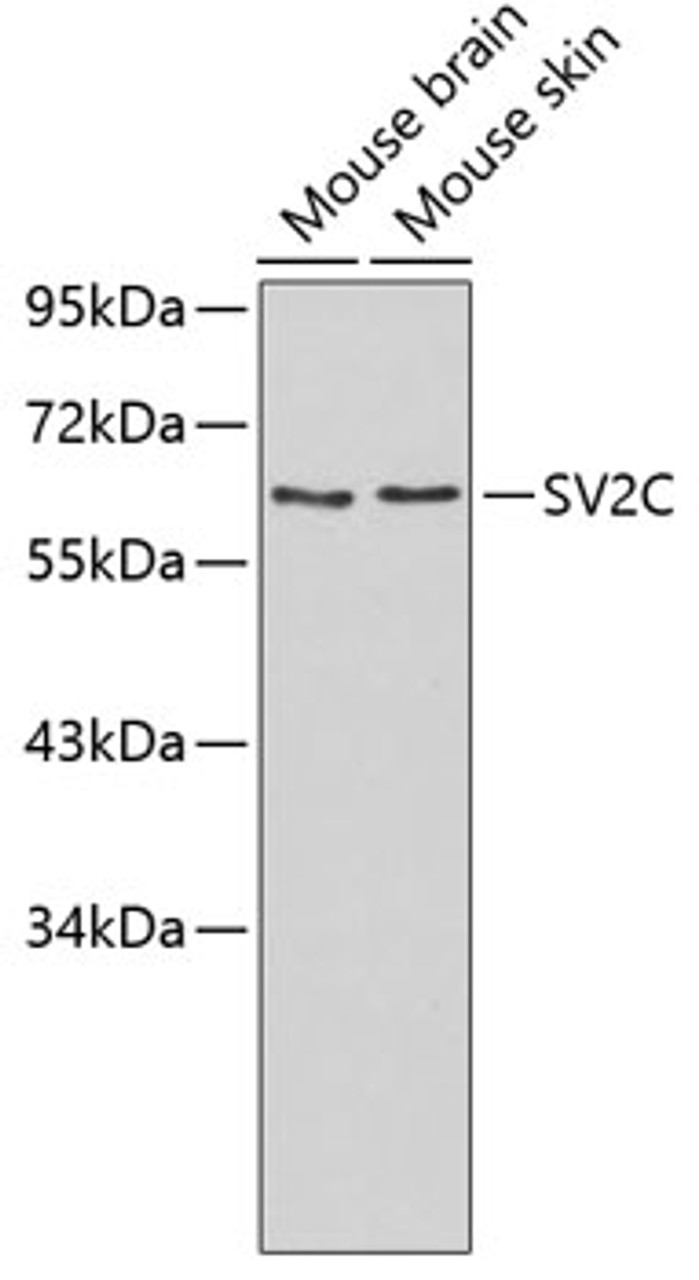 Western blot analysis of extracts of various cell lines, using SV2C antibody (19-053) .<br/>Secondary antibody: HRP Goat Anti-Rabbit IgG (H+L) at 1:10000 dilution.<br/>Lysates/proteins: 25ug per lane.<br/>Blocking buffer: 3% nonfat dry milk in TBST.