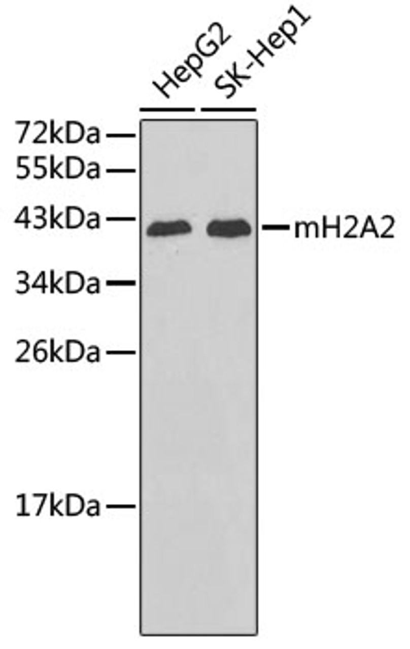 Western blot analysis of extracts of various cell lines, using H2AFY2 antibody (19-071) .<br/>Secondary antibody: HRP Goat Anti-Rabbit IgG (H+L) at 1:10000 dilution.<br/>Lysates/proteins: 25ug per lane.<br/>Blocking buffer: 3% nonfat dry milk in TBST.