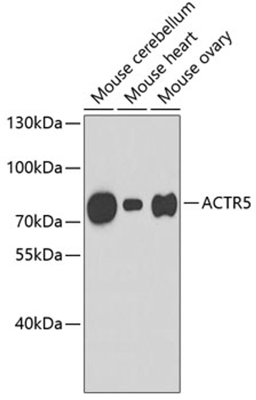 Western blot analysis of extracts of various cell lines, using ACTR5 antibody (19-080) .<br/>Secondary antibody: HRP Goat Anti-Rabbit IgG (H+L) at 1:10000 dilution.<br/>Lysates/proteins: 25ug per lane.<br/>Blocking buffer: 3% nonfat dry milk in TBST.
