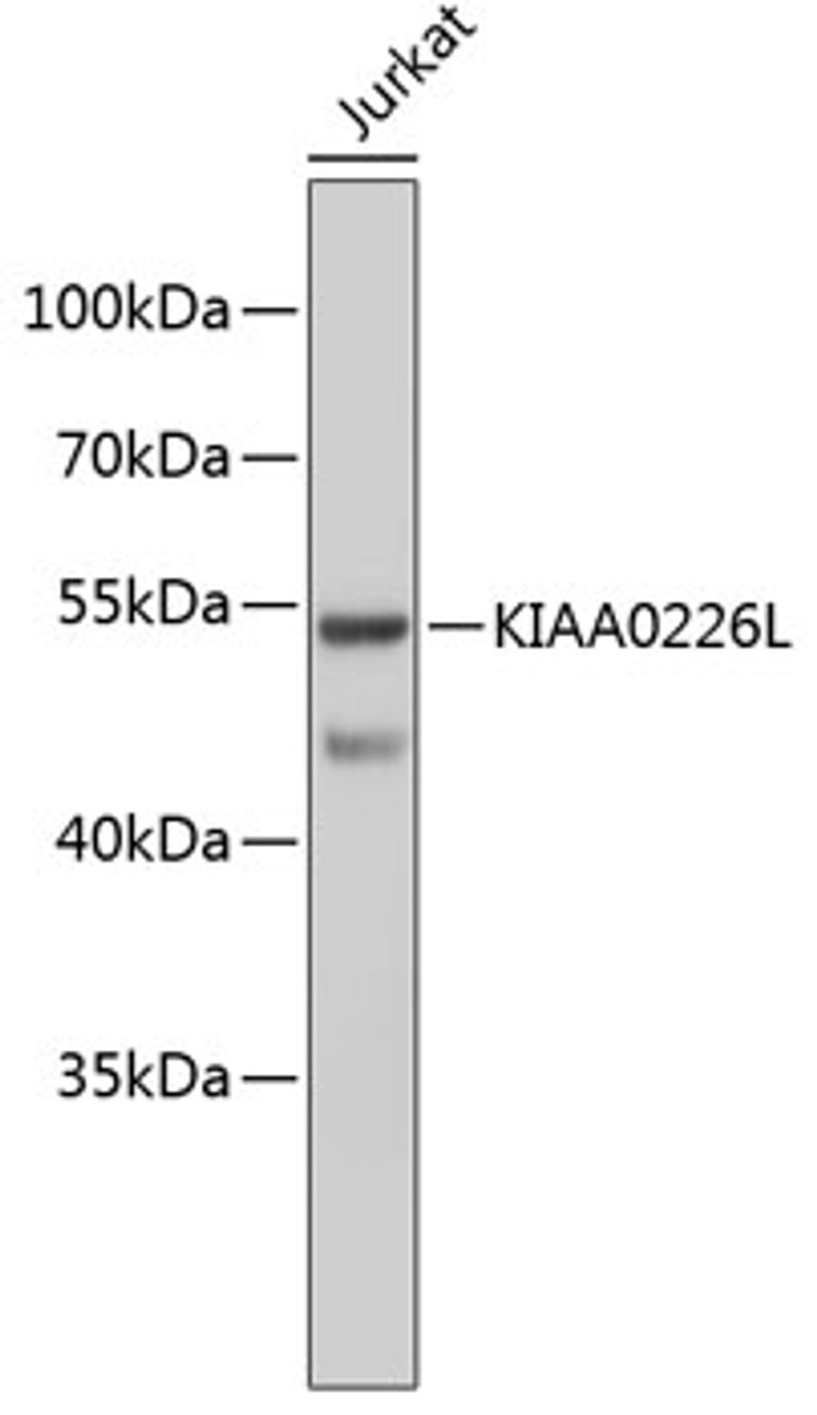 Western blot analysis of extracts of Jurkat cells, using KIAA0226L antibody (19-083) .<br/>Secondary antibody: HRP Goat Anti-Rabbit IgG (H+L) at 1:10000 dilution.<br/>Lysates/proteins: 25ug per lane.<br/>Blocking buffer: 3% nonfat dry milk in TBST.