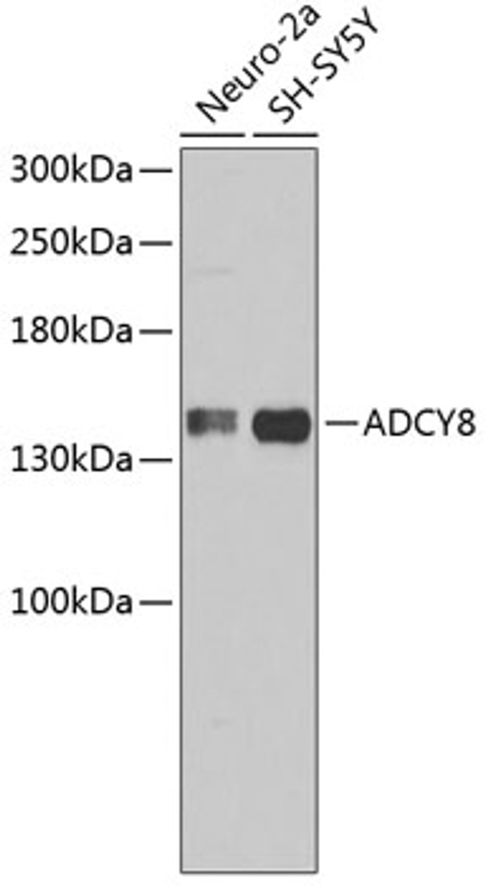 Western blot analysis of extracts of various cell lines, using ADCY8 antibody (19-093) .<br/>Secondary antibody: HRP Goat Anti-Rabbit IgG (H+L) at 1:10000 dilution.<br/>Lysates/proteins: 25ug per lane.<br/>Blocking buffer: 3% nonfat dry milk in TBST.