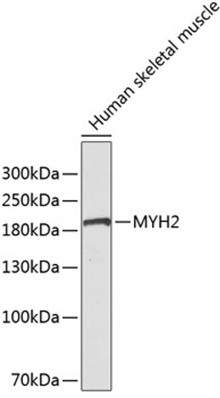 Western blot analysis of extracts of human skeletal muscle, using MYH2 antibody (19-106) .<br/>Secondary antibody: HRP Goat Anti-Rabbit IgG (H+L) at 1:10000 dilution.<br/>Lysates/proteins: 25ug per lane.<br/>Blocking buffer: 3% nonfat dry milk in TBST.