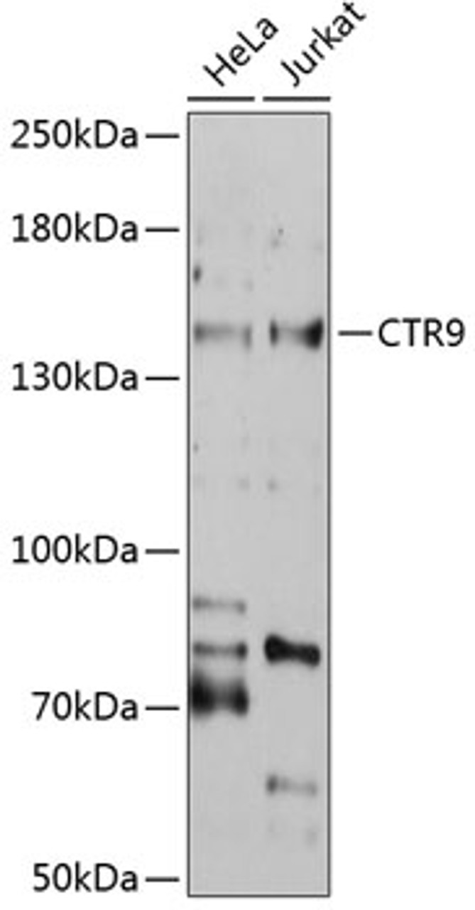 Western blot analysis of extracts of various cell lines, using CTR9 antibody (19-125) at 1:1000 dilution.<br/>Secondary antibody: HRP Goat Anti-Rabbit IgG (H+L) at 1:10000 dilution.<br/>Lysates/proteins: 25ug per lane.<br/>Blocking buffer: 3% nonfat dry milk in TBST.<br/>Detection: ECL Basic Kit.<br/>Exposure time: 30s.