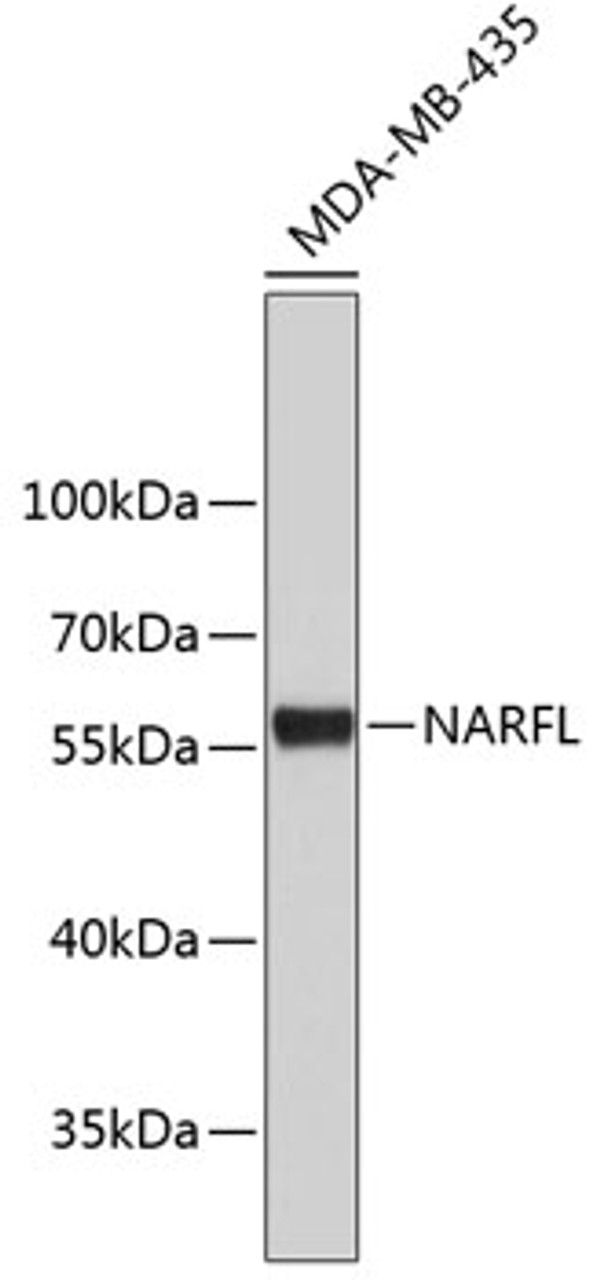 Western blot analysis of extracts of MDA-MB-435 cells, using NARFL antibody (19-129) .<br/>Secondary antibody: HRP Goat Anti-Rabbit IgG (H+L) at 1:10000 dilution.<br/>Lysates/proteins: 25ug per lane.<br/>Blocking buffer: 3% nonfat dry milk in TBST.