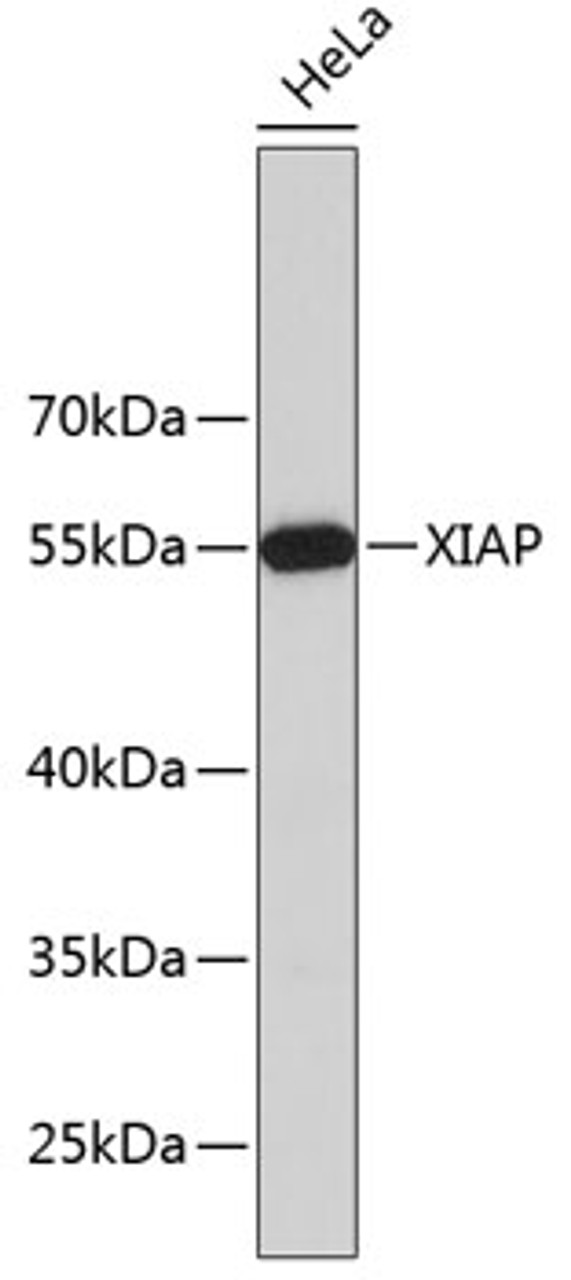 Western blot analysis of extracts of HeLa cells, using XIAP antibody (19-141) .<br/>Secondary antibody: HRP Goat Anti-Mouse IgG (H+L) (AS003) at 1:10000 dilution.<br/>Lysates/proteins: 25ug per lane.<br/>Blocking buffer: 3% nonfat dry milk in TBST.