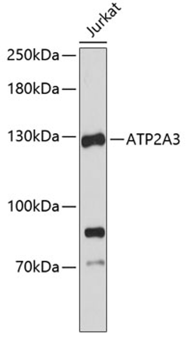 Western blot analysis of extracts of Jurkat cells, using ATP2A3 antibody (19-146) .<br/>Secondary antibody: HRP Goat Anti-Rabbit IgG (H+L) at 1:10000 dilution.<br/>Lysates/proteins: 25ug per lane.<br/>Blocking buffer: 3% nonfat dry milk in TBST.