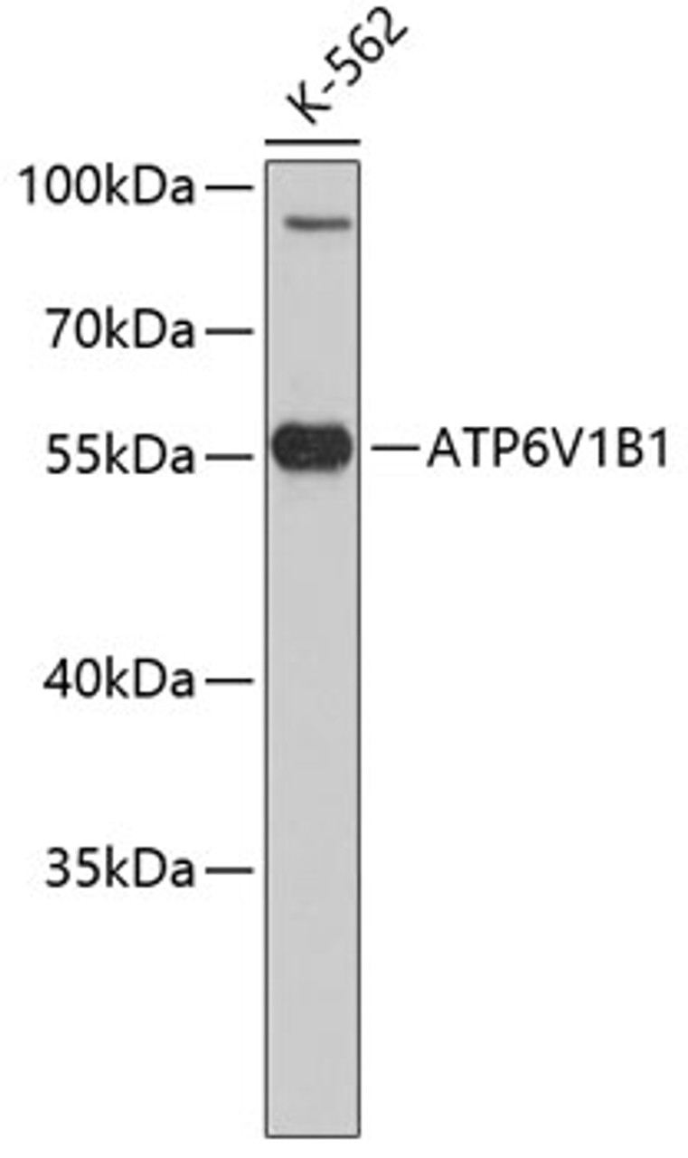 Western blot analysis of extracts of K-562 cells, using ATP6V1B1 antibody (19-148) .<br/>Secondary antibody: HRP Goat Anti-Rabbit IgG (H+L) at 1:10000 dilution.<br/>Lysates/proteins: 25ug per lane.<br/>Blocking buffer: 3% nonfat dry milk in TBST.