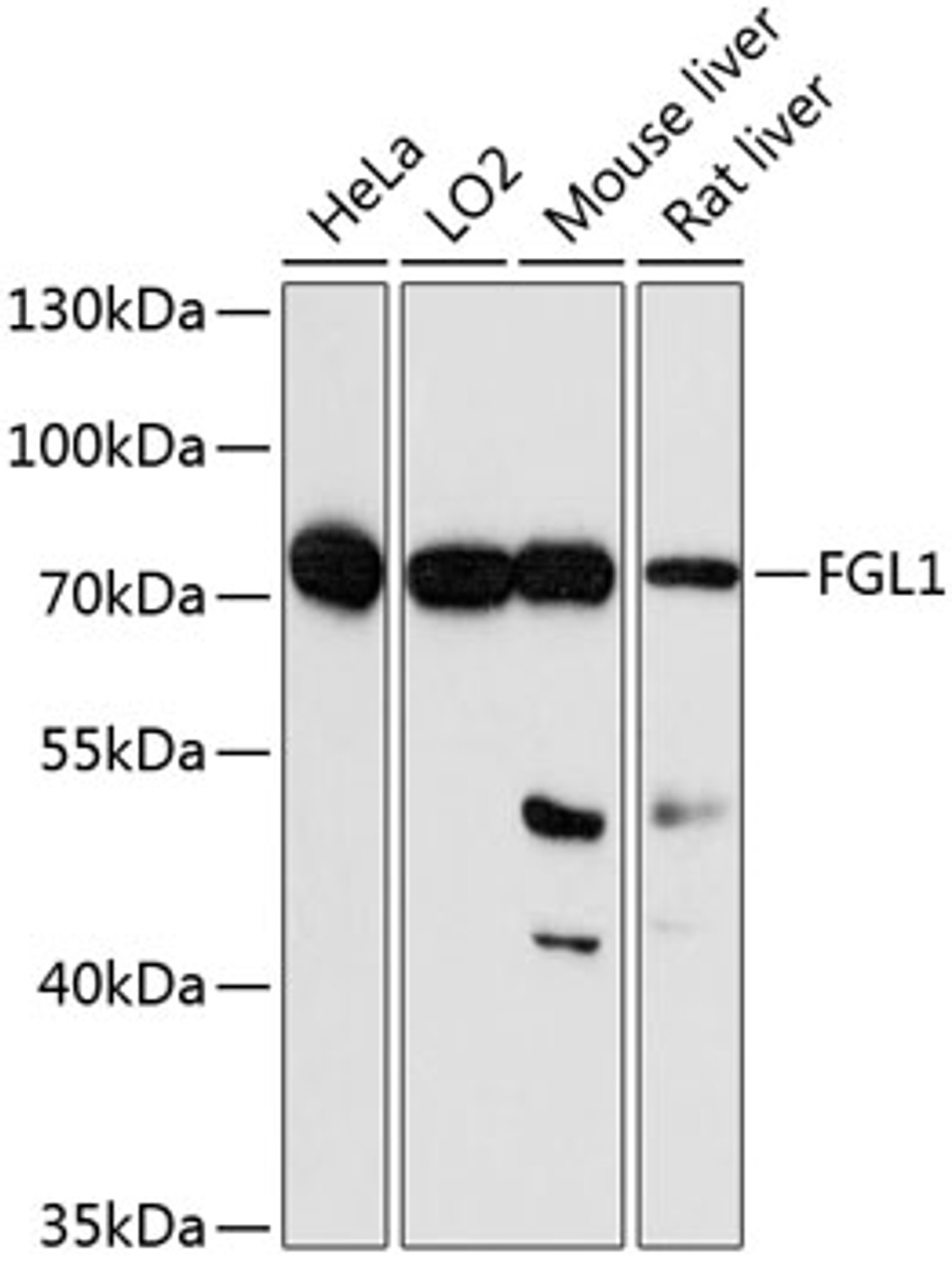 Western blot analysis of extracts of various cell lines, using FGL1 antibody (19-188) at 1:1000 dilution.<br/>Secondary antibody: HRP Goat Anti-Rabbit IgG (H+L) at 1:10000 dilution.<br/>Lysates/proteins: 25ug per lane.<br/>Blocking buffer: 3% nonfat dry milk in TBST.<br/>Detection: ECL Basic Kit.<br/>Exposure time: 90s.
