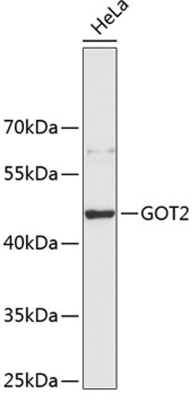 Western blot analysis of extracts of HeLa cells, using GOT2 antibody (19-200) .<br/>Secondary antibody: HRP Goat Anti-Rabbit IgG (H+L) at 1:10000 dilution.<br/>Lysates/proteins: 25ug per lane.<br/>Blocking buffer: 3% nonfat dry milk in TBST.