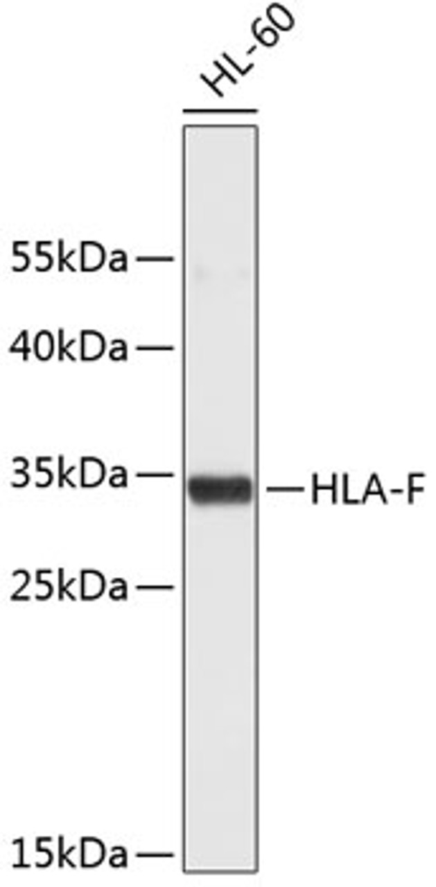 Western blot analysis of extracts of HL-60 cells, using HLA-F antibody (19-208) .<br/>Secondary antibody: HRP Goat Anti-Rabbit IgG (H+L) at 1:10000 dilution.<br/>Lysates/proteins: 25ug per lane.<br/>Blocking buffer: 3% nonfat dry milk in TBST.