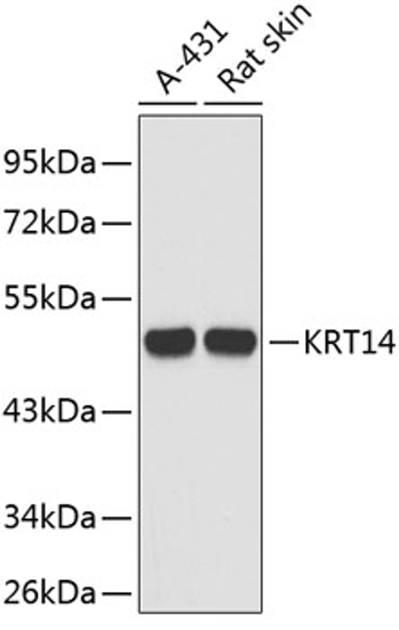 Western blot analysis of extracts of various cell lines, using KRT14 antibody (19-221) .<br/>Secondary antibody: HRP Goat Anti-Rabbit IgG (H+L) at 1:10000 dilution.<br/>Lysates/proteins: 25ug per lane.<br/>Blocking buffer: 3% nonfat dry milk in TBST.
