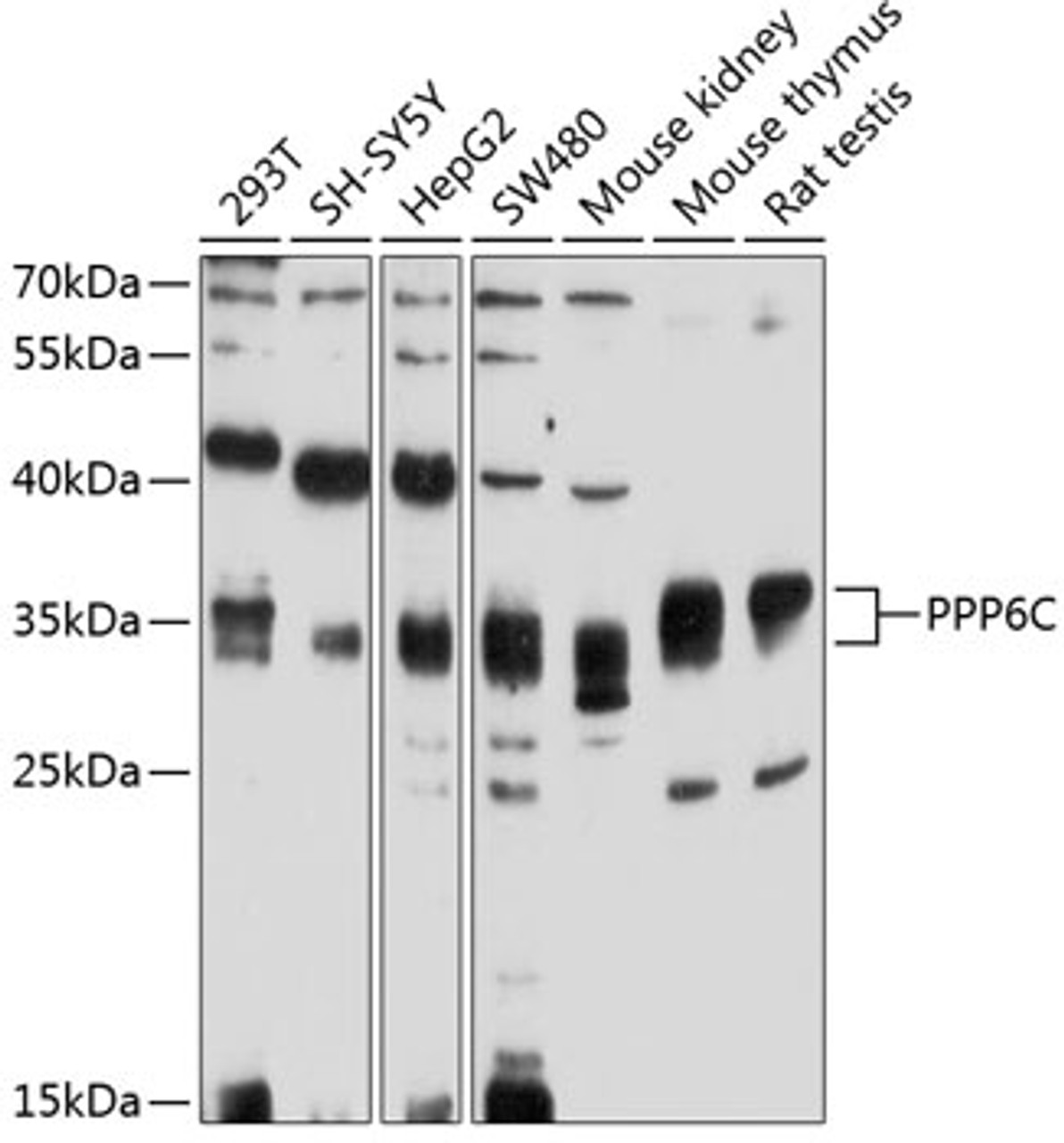 Western blot analysis of extracts of various cell lines, using PPP6C antibody (19-253) at 1:1000 dilution.<br/>Secondary antibody: HRP Goat Anti-Rabbit IgG (H+L) at 1:10000 dilution.<br/>Lysates/proteins: 25ug per lane.<br/>Blocking buffer: 3% nonfat dry milk in TBST.<br/>Detection: ECL Enhanced Kit.<br/>Exposure time: 90s.