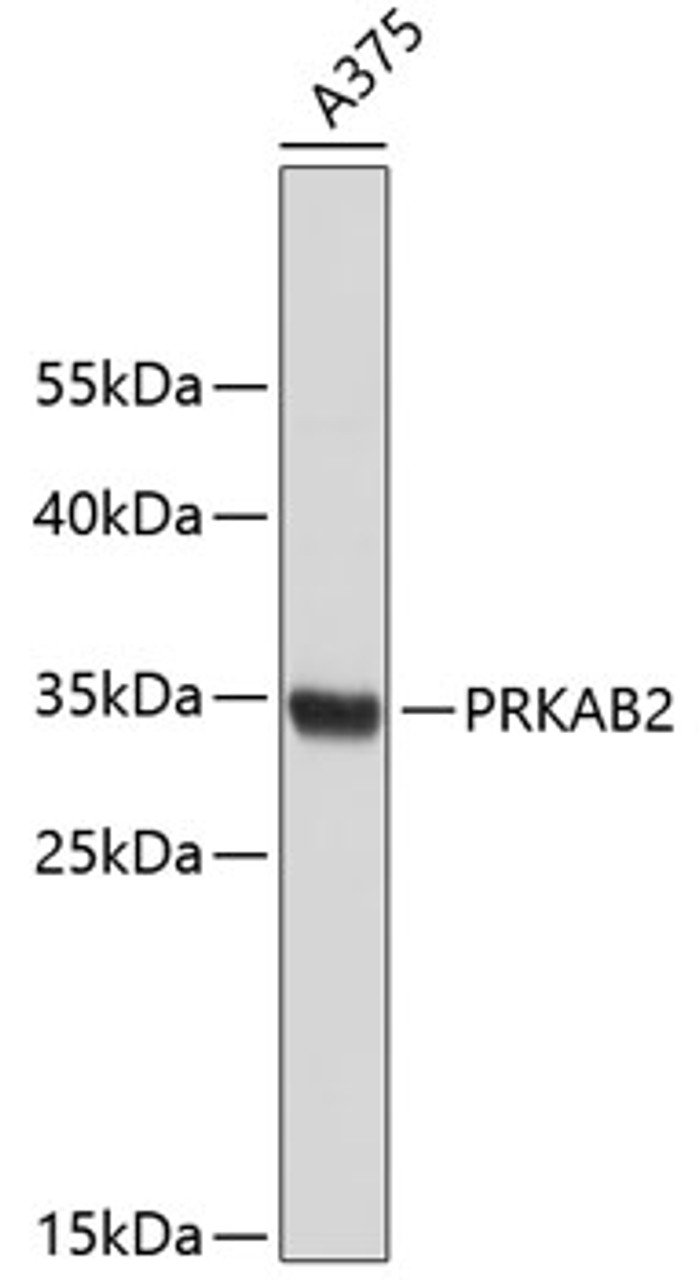 Western blot analysis of extracts of A-357 cells, using PRKAB2 antibody (19-254) .<br/>Secondary antibody: HRP Goat Anti-Rabbit IgG (H+L) at 1:10000 dilution.<br/>Lysates/proteins: 25ug per lane.<br/>Blocking buffer: 3% nonfat dry milk in TBST.