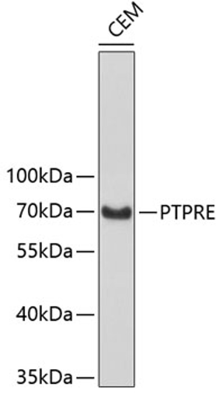 Western blot analysis of extracts of CEM cells, using PTPRE antibody (19-262) .<br/>Secondary antibody: HRP Goat Anti-Rabbit IgG (H+L) at 1:10000 dilution.<br/>Lysates/proteins: 25ug per lane.<br/>Blocking buffer: 3% nonfat dry milk in TBST.