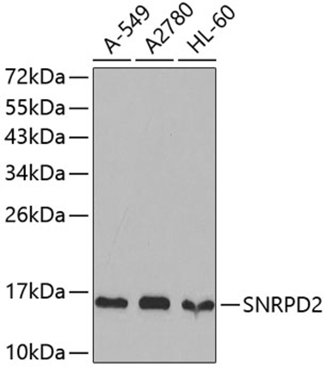 Western blot analysis of extracts of various cell lines, using SNRPD2 antibody (19-285) .<br/>Secondary antibody: HRP Goat Anti-Rabbit IgG (H+L) at 1:10000 dilution.<br/>Lysates/proteins: 25ug per lane.<br/>Blocking buffer: 3% nonfat dry milk in TBST.