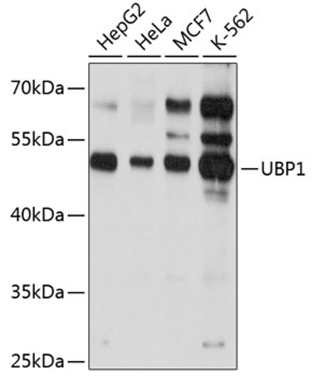 Western blot analysis of extracts of various cell lines, using UBP1 antibody (19-298) at 1:1000 dilution.<br/>Secondary antibody: HRP Goat Anti-Rabbit IgG (H+L) at 1:10000 dilution.<br/>Lysates/proteins: 25ug per lane.<br/>Blocking buffer: 3% nonfat dry milk in TBST.<br/>Detection: ECL Basic Kit.<br/>Exposure time: 20s.