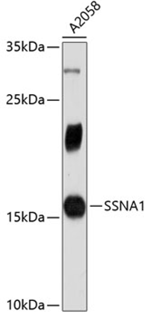 Western blot analysis of extracts of A2058 cells, using SSNA1 antibody (19-315) .<br/>Secondary antibody: HRP Goat Anti-Rabbit IgG (H+L) at 1:10000 dilution.<br/>Lysates/proteins: 25ug per lane.<br/>Blocking buffer: 3% nonfat dry milk in TBST.