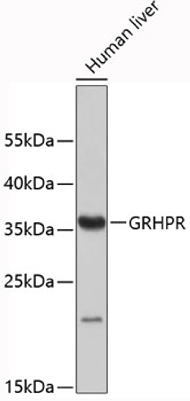Western blot analysis of extracts of human liver, using GRHPR antibody (19-334) .<br/>Secondary antibody: HRP Goat Anti-Rabbit IgG (H+L) at 1:10000 dilution.<br/>Lysates/proteins: 25ug per lane.<br/>Blocking buffer: 3% nonfat dry milk in TBST.