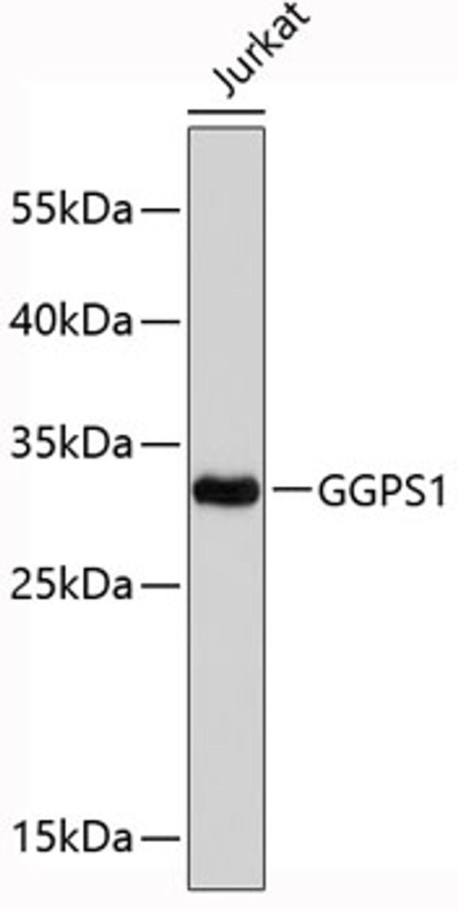 Western blot analysis of extracts of Jurkat cells, using GGPS1 antibody (19-335) .<br/>Secondary antibody: HRP Goat Anti-Rabbit IgG (H+L) at 1:10000 dilution.<br/>Lysates/proteins: 25ug per lane.<br/>Blocking buffer: 3% nonfat dry milk in TBST.