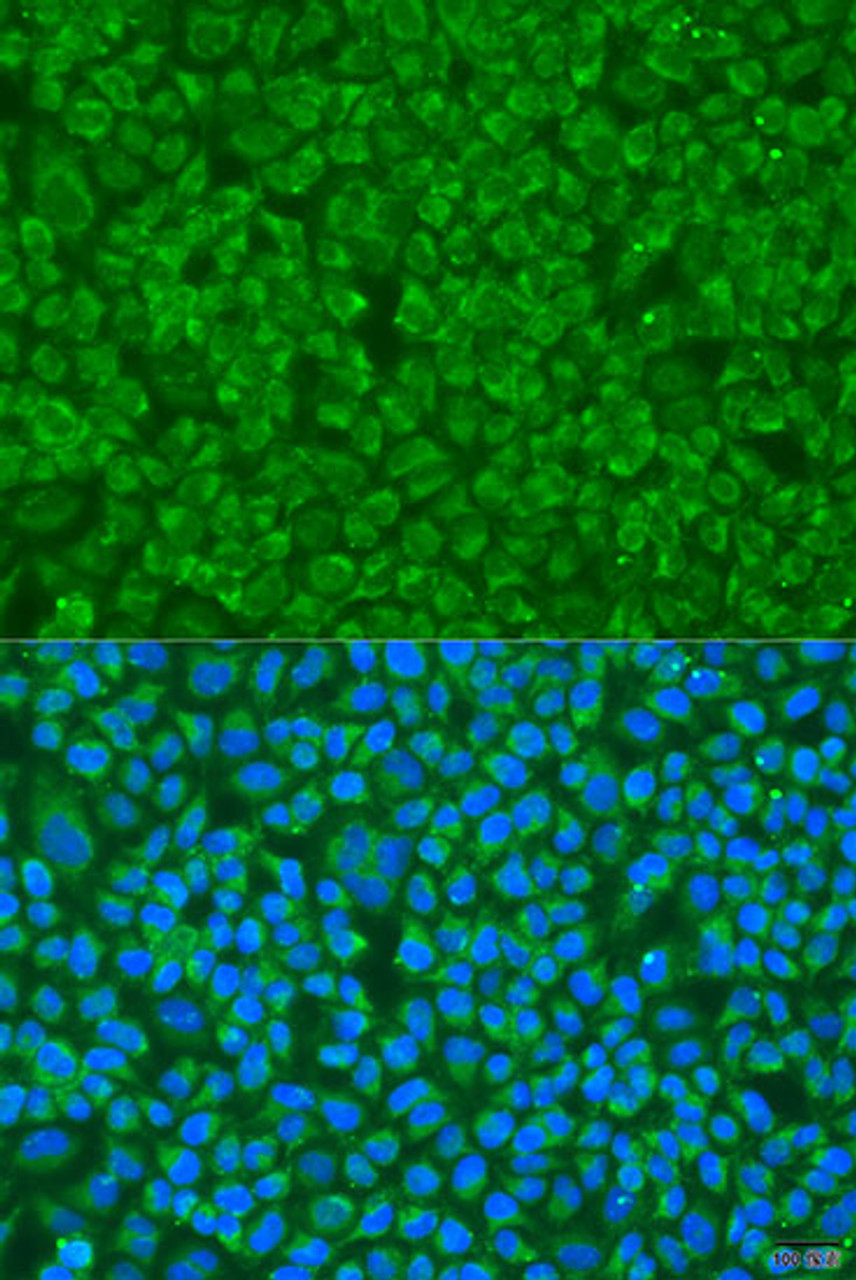 Immunofluorescence analysis of U2OS cells using GOSR1 antibody (19-339) at dilution of 1:100. Blue: DAPI for nuclear staining.