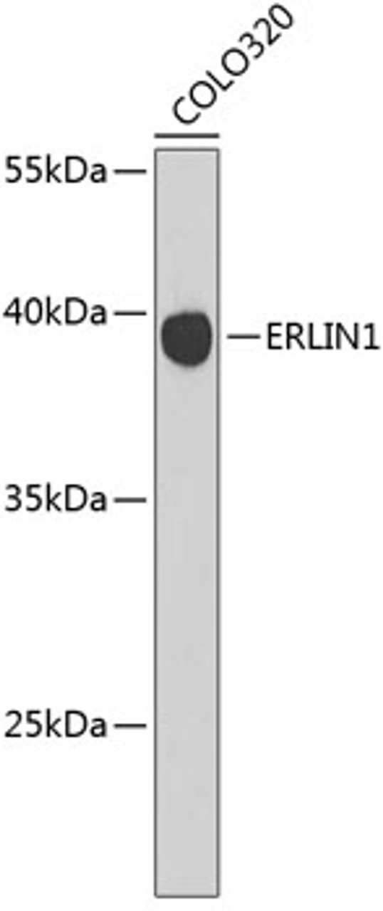 Western blot analysis of extracts of COLO320 cells, using ERLIN1 antibody (19-370) .<br/>Secondary antibody: HRP Goat Anti-Rabbit IgG (H+L) at 1:10000 dilution.<br/>Lysates/proteins: 25ug per lane.<br/>Blocking buffer: 3% nonfat dry milk in TBST.