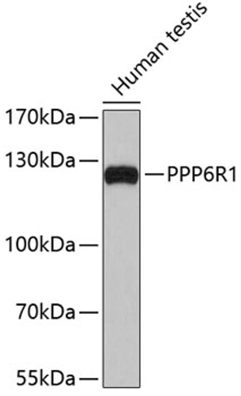 Western blot analysis of extracts of human testis, using PPP6R1 antibody (19-402) .<br/>Secondary antibody: HRP Goat Anti-Rabbit IgG (H+L) at 1:10000 dilution.<br/>Lysates/proteins: 25ug per lane.<br/>Blocking buffer: 3% nonfat dry milk in TBST.