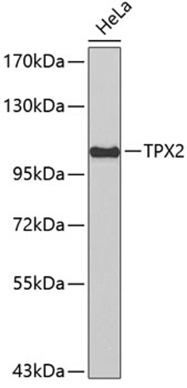 Western blot analysis of extracts of HeLa cells, using TPX2 antibody (19-404) .<br/>Secondary antibody: HRP Goat Anti-Rabbit IgG (H+L) at 1:10000 dilution.<br/>Lysates/proteins: 25ug per lane.<br/>Blocking buffer: 3% nonfat dry milk in TBST.