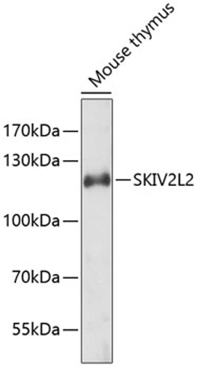 Western blot analysis of extracts of mouse thymus, using SKIV2L2 antibody (19-413) .<br/>Secondary antibody: HRP Goat Anti-Rabbit IgG (H+L) at 1:10000 dilution.<br/>Lysates/proteins: 25ug per lane.<br/>Blocking buffer: 3% nonfat dry milk in TBST.