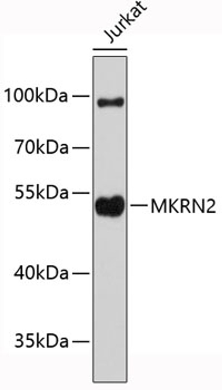 Western blot analysis of extracts of Jurkat cells, using MKRN2 antibody (19-416) .<br/>Secondary antibody: HRP Goat Anti-Mouse IgG (H+L) (AS003) at 1:10000 dilution.<br/>Lysates/proteins: 25ug per lane.<br/>Blocking buffer: 3% nonfat dry milk in TBST.