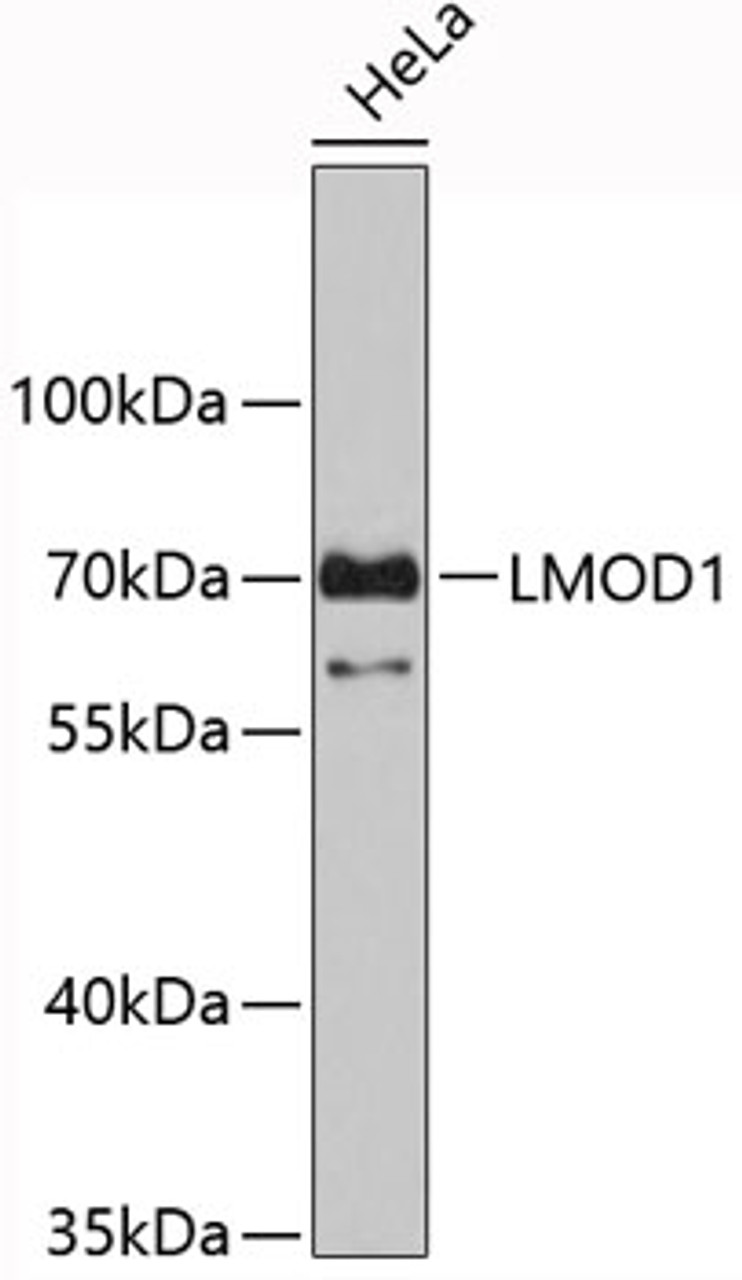 Western blot analysis of extracts of HeLa cells, using LMOD1 antibody (19-419) .<br/>Secondary antibody: HRP Goat Anti-Rabbit IgG (H+L) at 1:10000 dilution.<br/>Lysates/proteins: 25ug per lane.<br/>Blocking buffer: 3% nonfat dry milk in TBST.