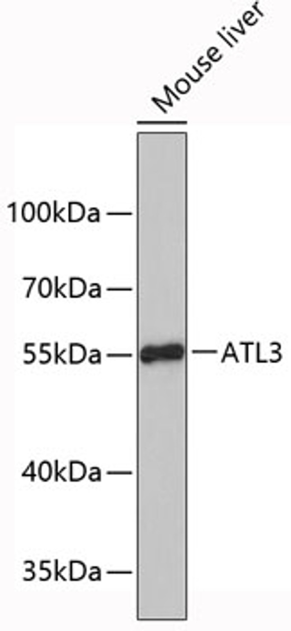 Western blot analysis of extracts of mouse liver, using ATL3 antibody (19-422) .<br/>Secondary antibody: HRP Goat Anti-Rabbit IgG (H+L) at 1:10000 dilution.<br/>Lysates/proteins: 25ug per lane.<br/>Blocking buffer: 3% nonfat dry milk in TBST.
