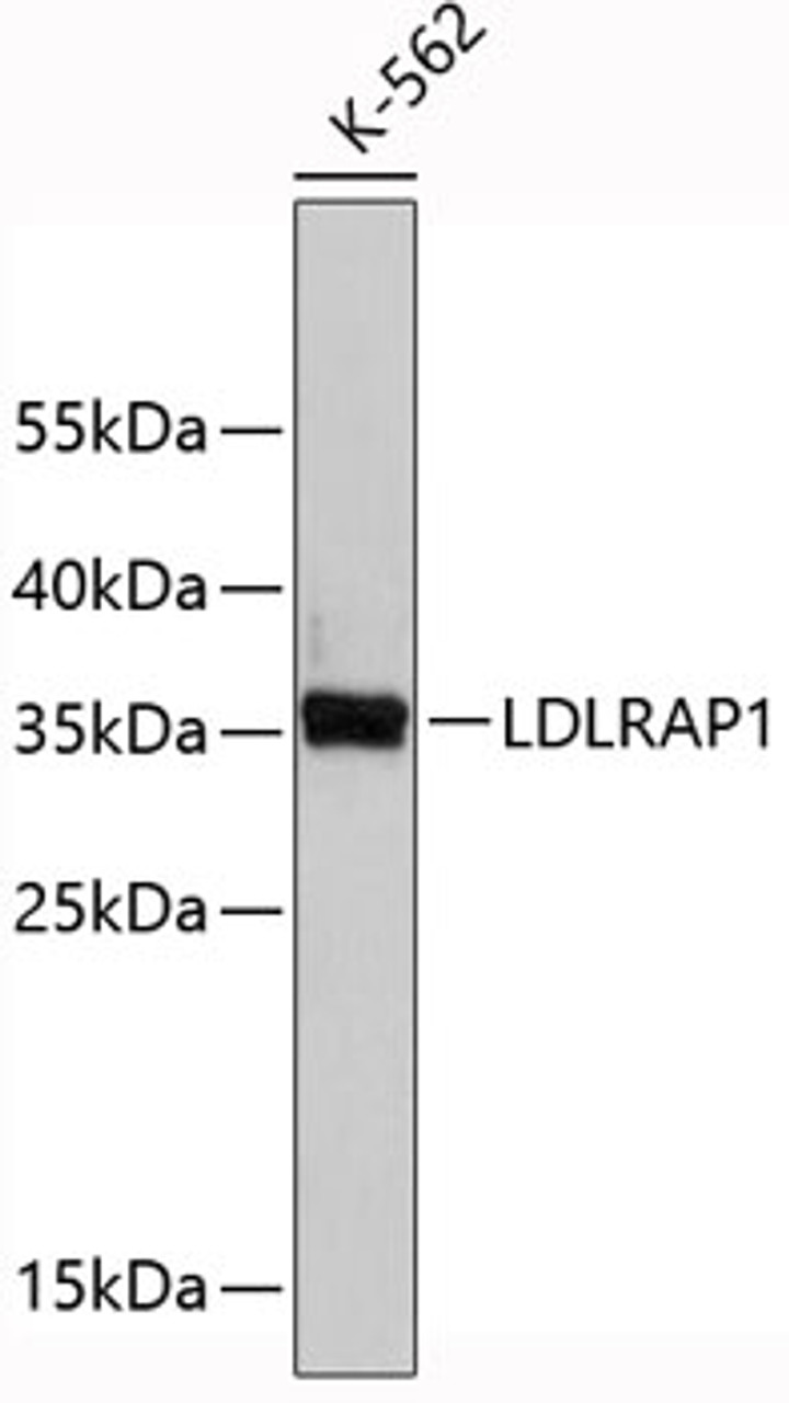 Western blot analysis of extracts of K-562 cells, using LDLRAP1 antibody (19-427) .<br/>Secondary antibody: HRP Goat Anti-Rabbit IgG (H+L) at 1:10000 dilution.<br/>Lysates/proteins: 25ug per lane.<br/>Blocking buffer: 3% nonfat dry milk in TBST.