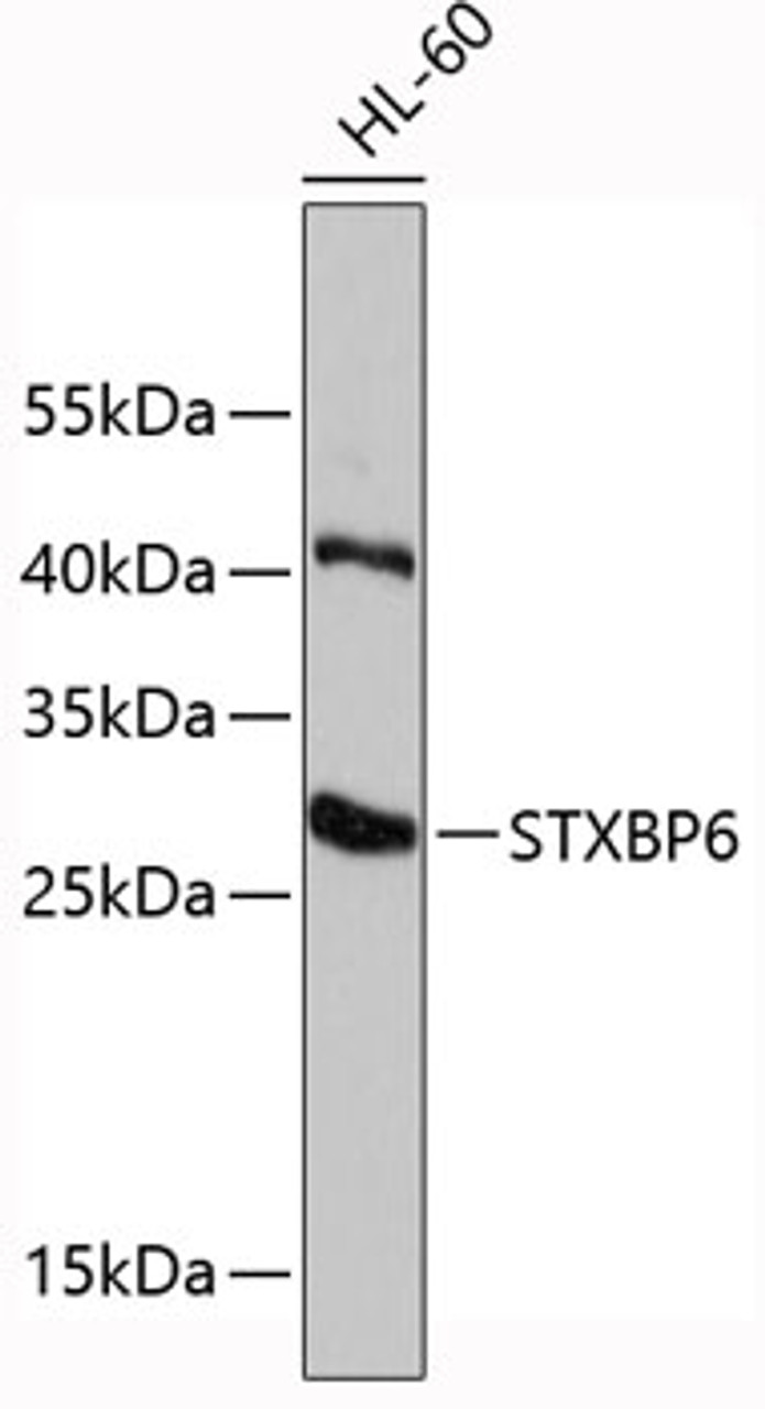 Western blot analysis of extracts of HL-60 cells, using STXBP6 antibody (19-440) .<br/>Secondary antibody: HRP Goat Anti-Rabbit IgG (H+L) at 1:10000 dilution.<br/>Lysates/proteins: 25ug per lane.<br/>Blocking buffer: 3% nonfat dry milk in TBST.