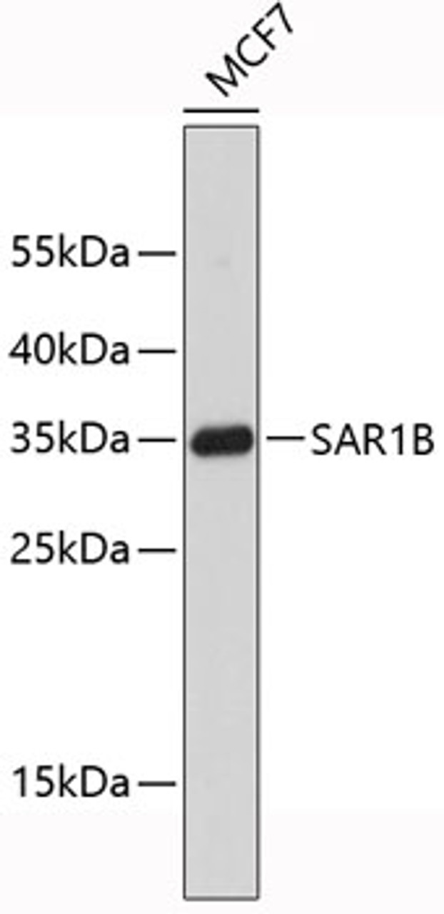 Western blot analysis of extracts of MCF-7 cells, using SAR1B antibody (19-449) .<br/>Secondary antibody: HRP Goat Anti-Rabbit IgG (H+L) at 1:10000 dilution.<br/>Lysates/proteins: 25ug per lane.<br/>Blocking buffer: 3% nonfat dry milk in TBST.