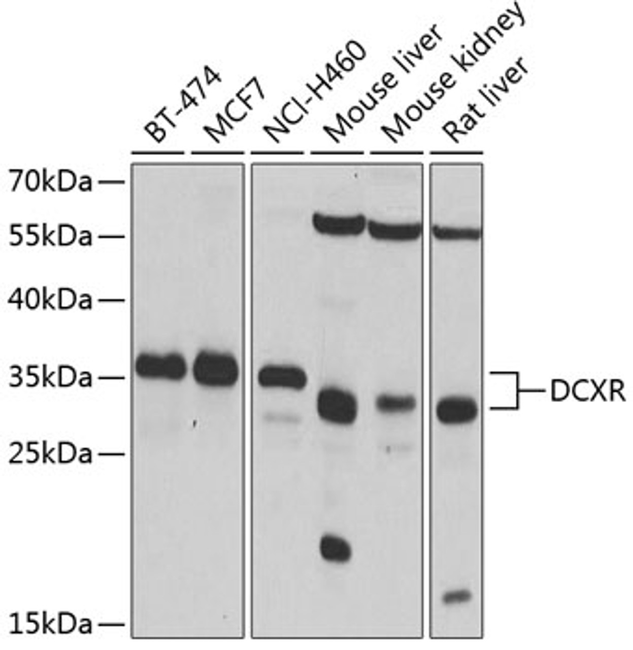 Western blot analysis of extracts of various cell lines, using DCXR antibody (19-452) at 1:1000 dilution.<br/>Secondary antibody: HRP Goat Anti-Rabbit IgG (H+L) at 1:10000 dilution.<br/>Lysates/proteins: 25ug per lane.<br/>Blocking buffer: 3% nonfat dry milk in TBST.<br/>Detection: ECL Basic Kit.<br/>Exposure time: 5s.