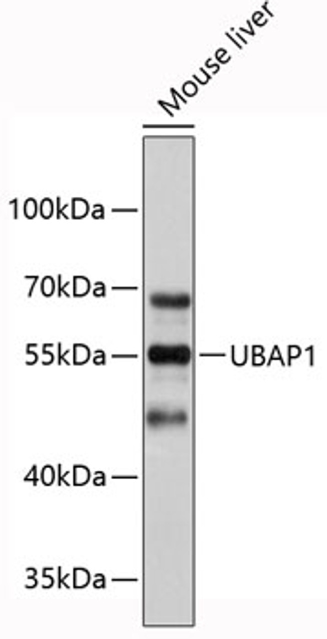 Western blot analysis of extracts of mouse liver, using UBAP1 antibody (19-453) .<br/>Secondary antibody: HRP Goat Anti-Rabbit IgG (H+L) at 1:10000 dilution.<br/>Lysates/proteins: 25ug per lane.<br/>Blocking buffer: 3% nonfat dry milk in TBST.