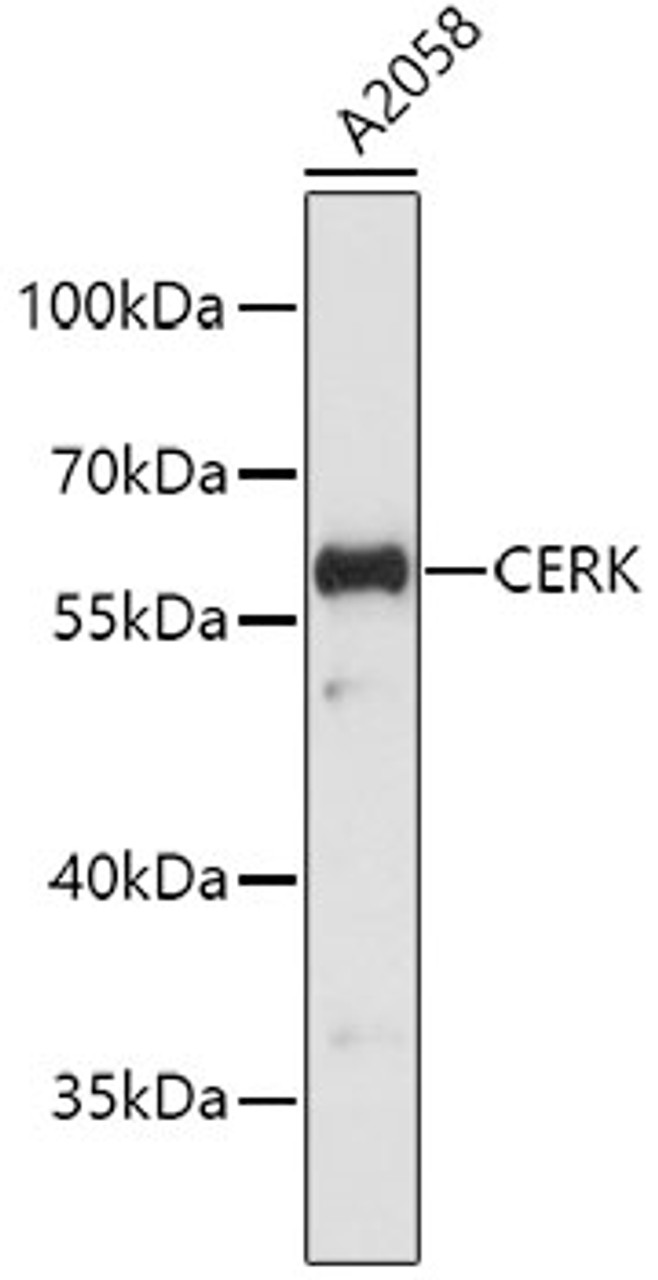 Western blot analysis of extracts of A2058 cells, using CERK antibody (19-500) .<br/>Secondary antibody: HRP Goat Anti-Rabbit IgG (H+L) at 1:10000 dilution.<br/>Lysates/proteins: 25ug per lane.<br/>Blocking buffer: 3% nonfat dry milk in TBST.