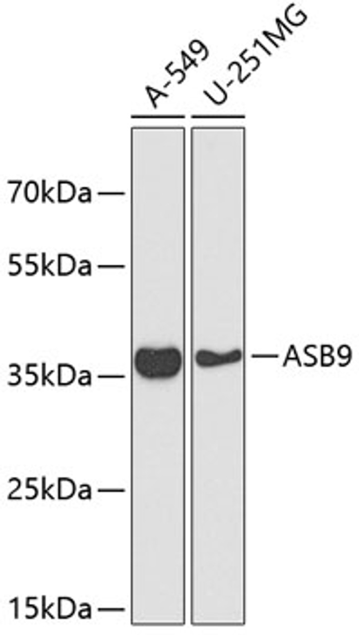 Western blot analysis of extracts of various cell lines, using ASB9 antibody (19-538) at 1:1000 dilution.<br/>Secondary antibody: HRP Goat Anti-Rabbit IgG (H+L) at 1:10000 dilution.<br/>Lysates/proteins: 25ug per lane.<br/>Blocking buffer: 3% nonfat dry milk in TBST.