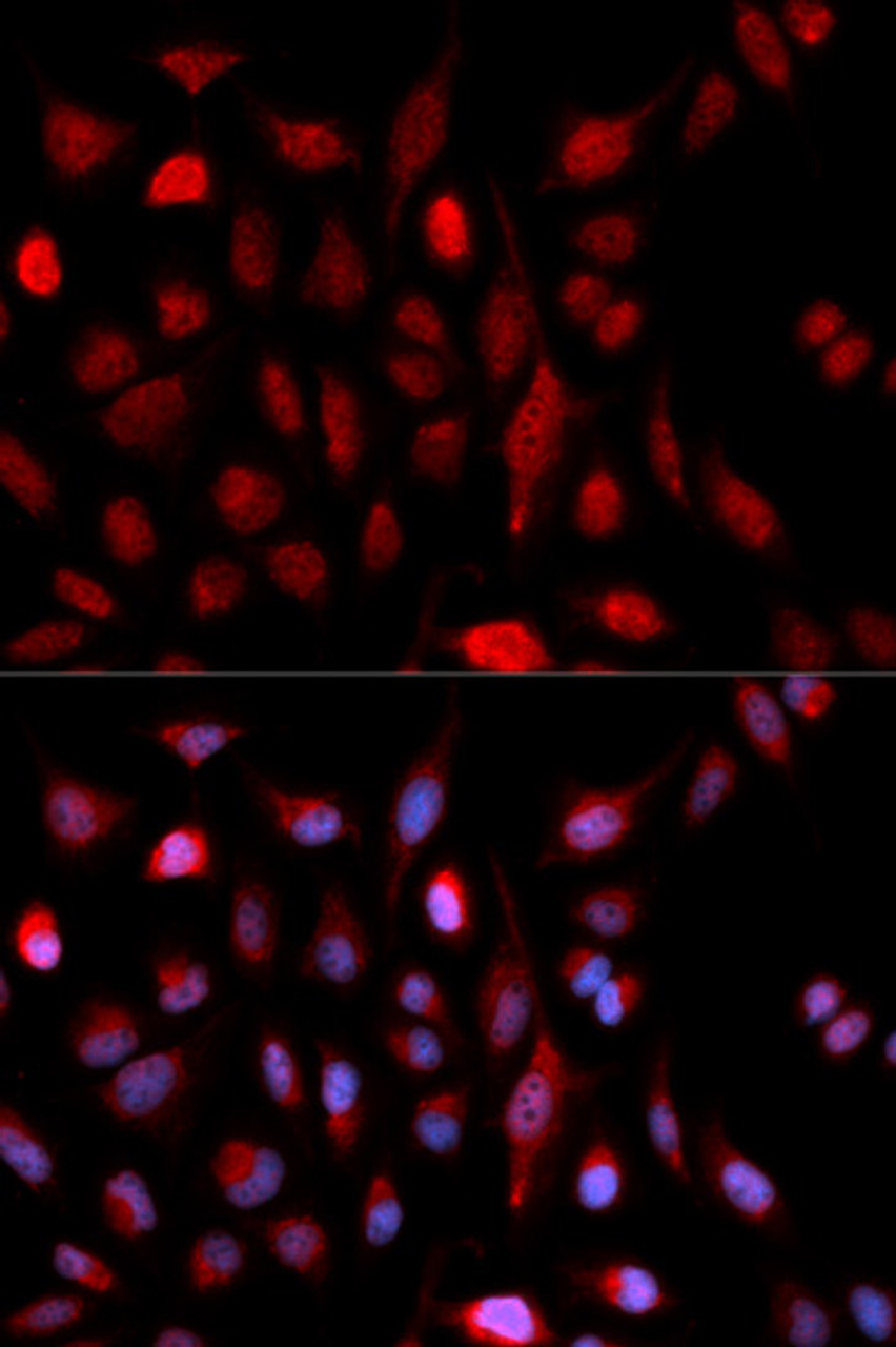 Immunofluorescence analysis of U2OS cells using ASH2L antibody (19-635) . Blue: DAPI for nuclear staining.