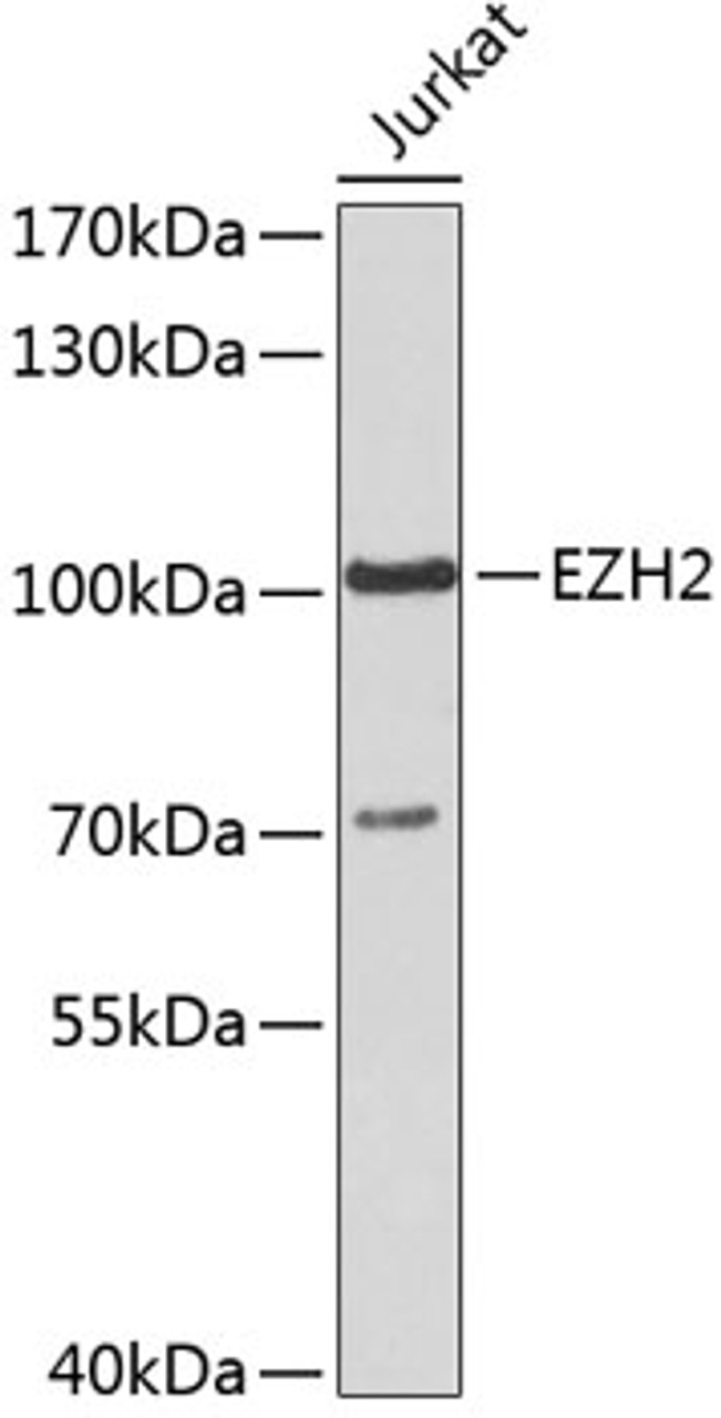 Western blot analysis of extracts of Jurkat cells, using EZH2 antibody (19-715) .<br/>Secondary antibody: HRP Goat Anti-Rabbit IgG (H+L) at 1:10000 dilution.<br/>Lysates/proteins: 25ug per lane.<br/>Blocking buffer: 3% nonfat dry milk in TBST.